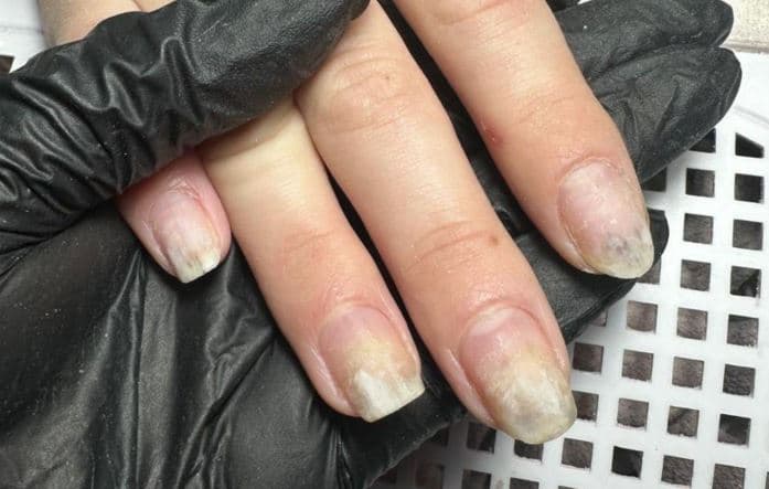 Uñas de las manos observadas durante una atención en consultorio