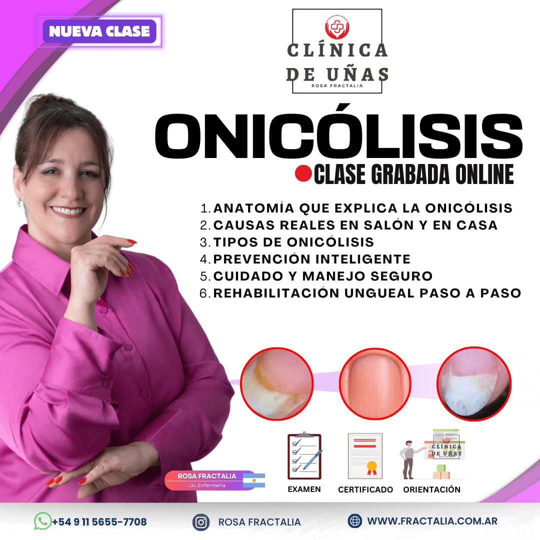 Flyer informativo de la clase online Onicólisis